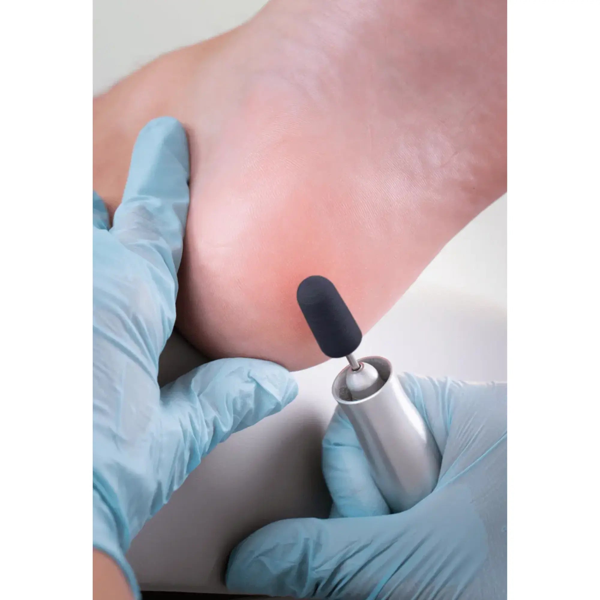 Capuchons abrasifs coniques x10 1501 - Diamant - Grain fin - Abrasion des cors, durillons et hyperkératoses - 5 mm Ruck