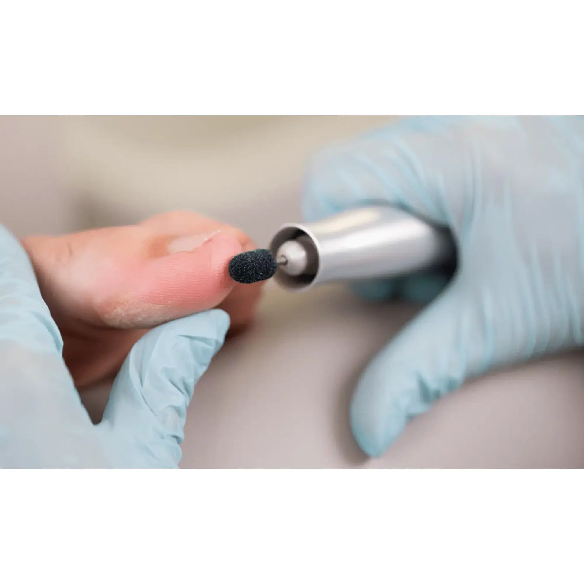 Capuchons abrasifs ronds x10 0502 - Diamant - Grain moyen - Abrasion des cors, durillons et hyperkératoses - 13 mm Ruck