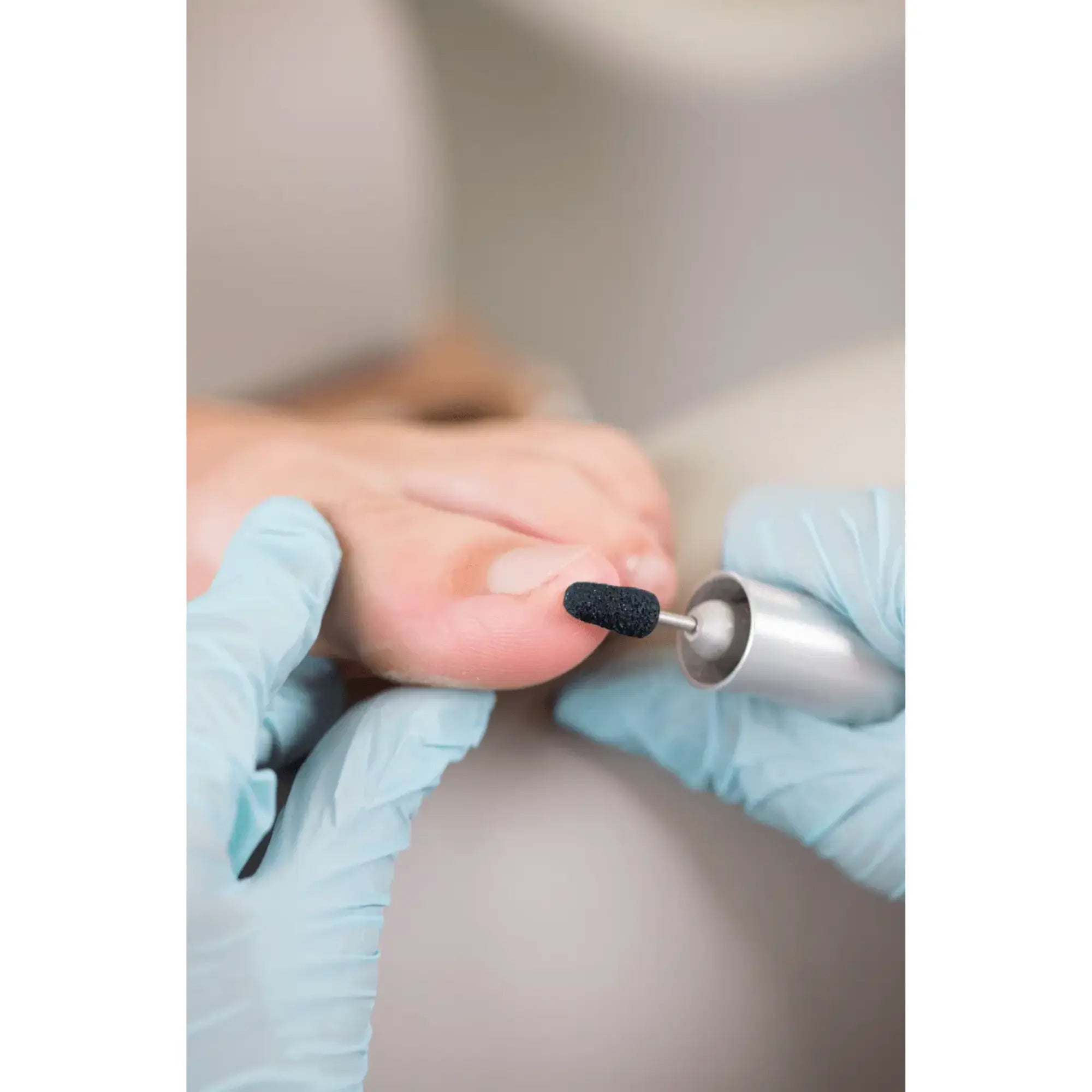 Capuchons abrasifs ronds x10 0502 - Diamant - Grain moyen - Abrasion des cors, durillons et hyperkératoses - 13 mm Ruck