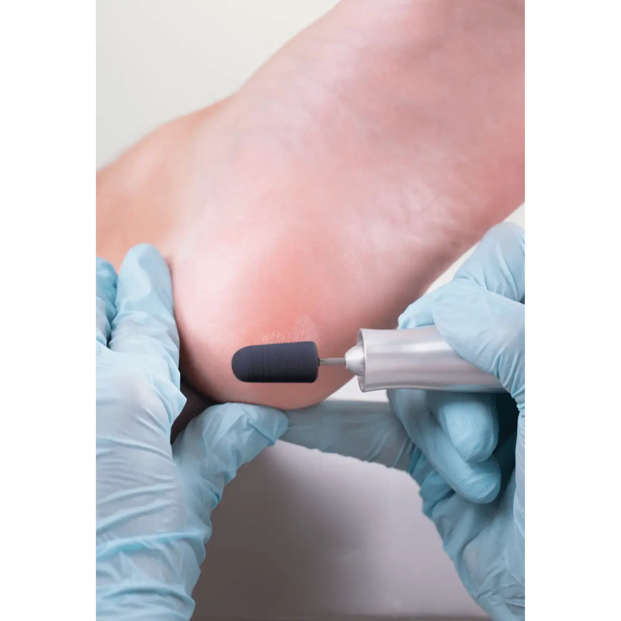 Capuchons abrasifs ronds x10 0503 - Diamant - Grain gros - Abrasion des cors, durillons et hyperkératoses - 13 mm Ruck