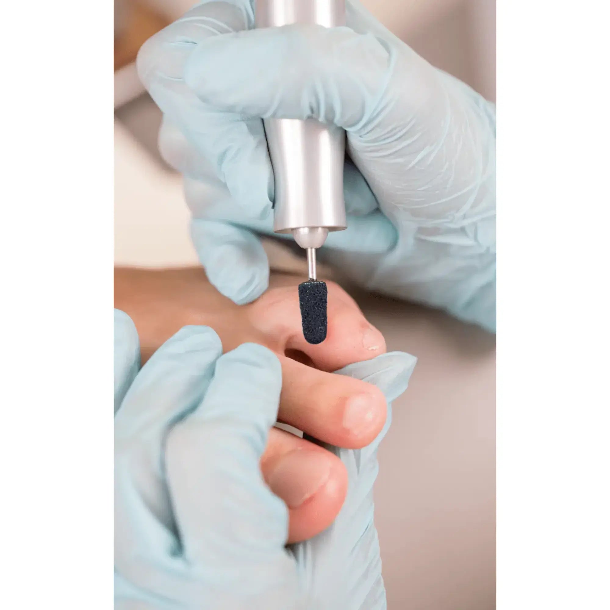 Capuchons abrasifs ronds x10 1301 - Diamant - Grain fin - Abrasion des cors, durillons et hyperkératoses - 5 mm Ruck