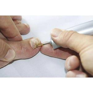 Fraise 1SXM Carbure de tungstène - Abrasion cors et mycoses ongles - 1 mm - My Podologie