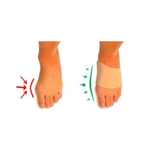 Protection Hallux Valgus - Taille S - Herbitas Fresco Podologia