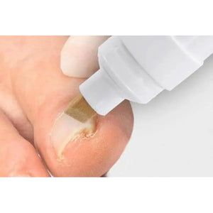 Stylo Aktivator B/S - Préparation de l'ongle - 8 ml - My Podologie