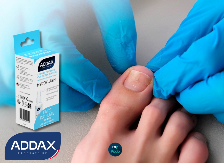 Mycoses des ongles : Laboratoire Addax, grand gagnant selon ALLOPODO !