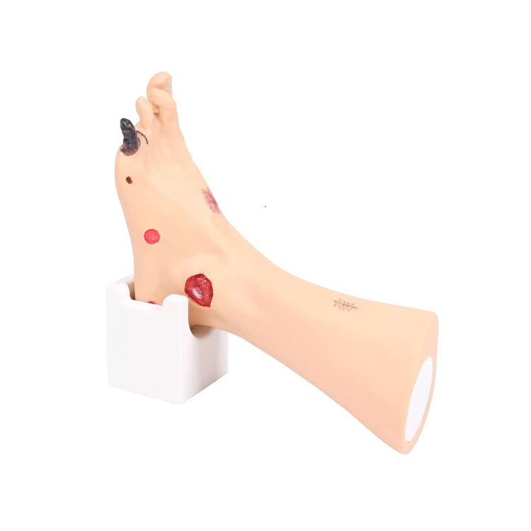 Modèle de pied avec plaies - Anatomie et pathologie My Podologie 