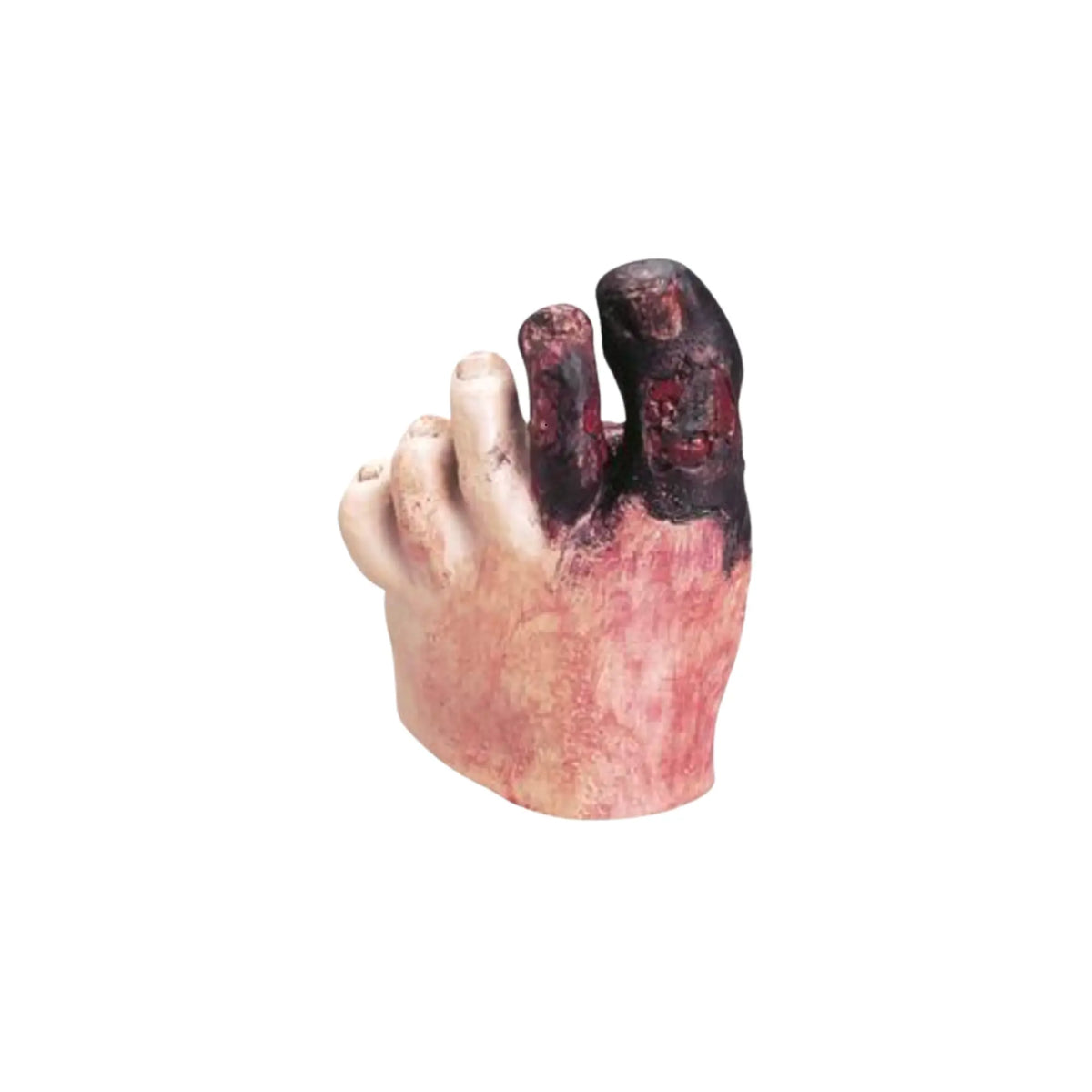 Modèle de pied diabétique avec plaie - Life form 3B Scientific 