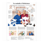 Tablica anatomiczna - Choroba Alzheimera - Anatomia i patologia