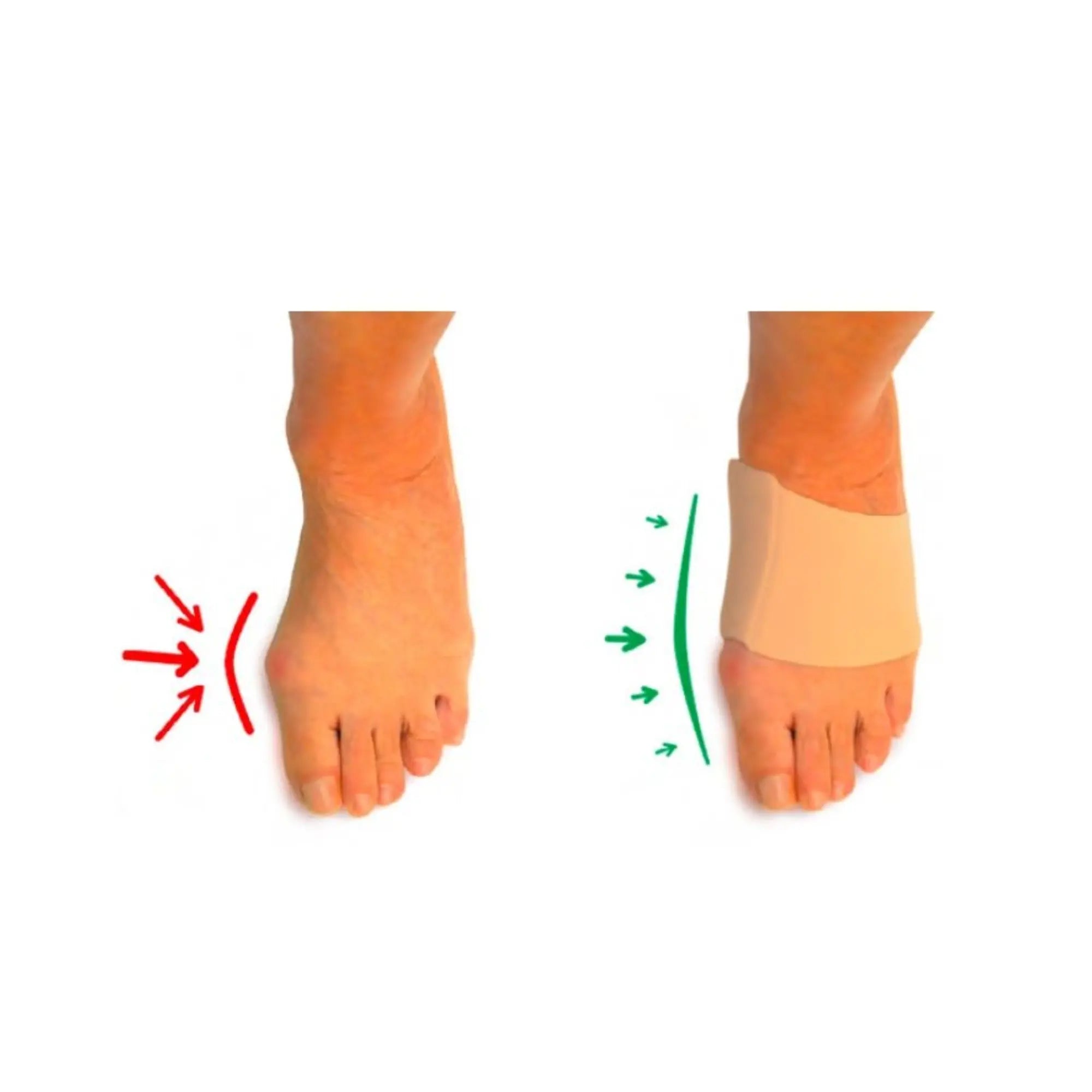 Protection Hallux Valgus - Taille S - Herbitas Fresco Podologia